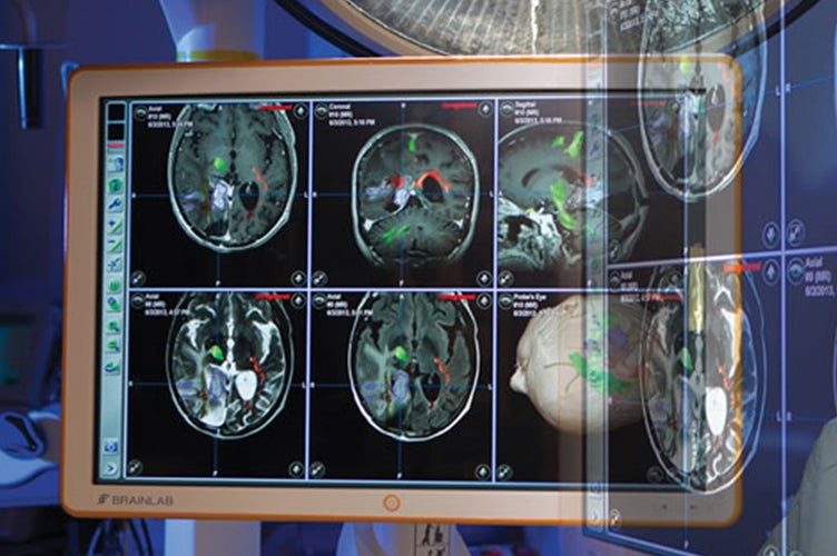 Brain scans with various highlights on them fill a giant computer screen.